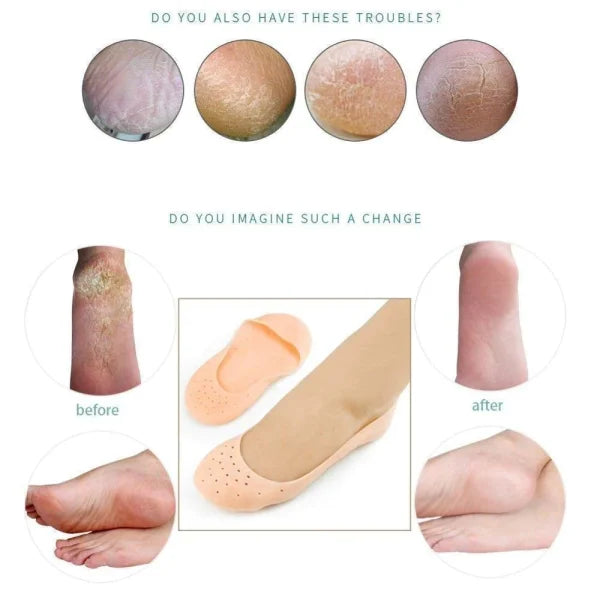 Silicone Gel Moisturizing Socks for Foot Care - SHOPIZEM