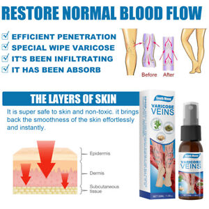 Veins Treatment Spray - SHOPIZEM