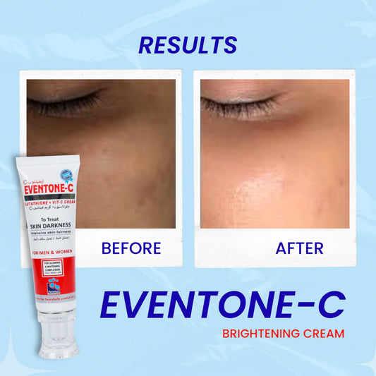Eventone-C Cream - SHOPIZEM