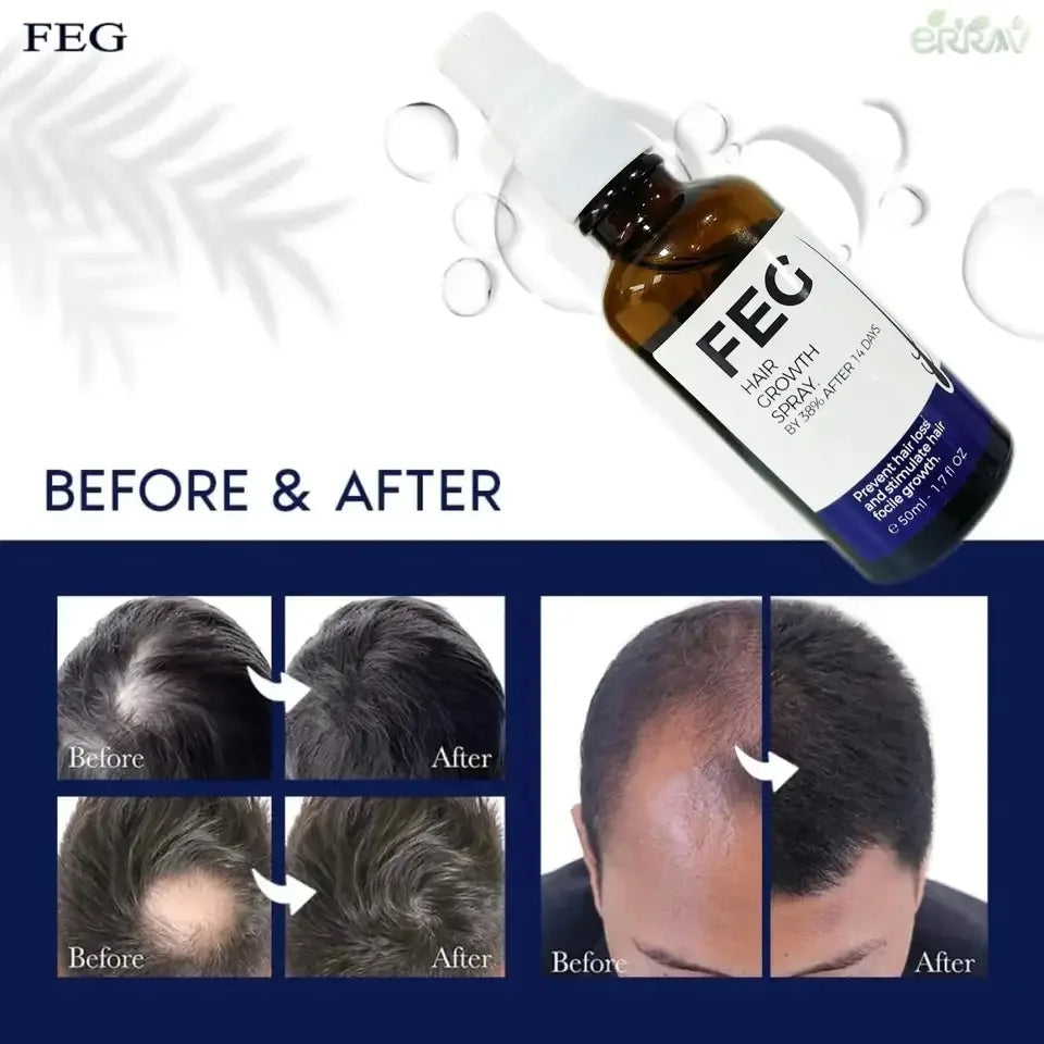 FEG PLUS Hair Growth Spray - SHOPIZEM