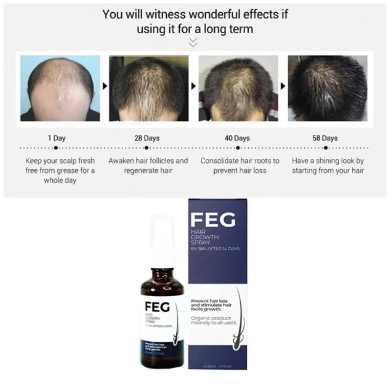 FEG PLUS Hair Growth Spray - SHOPIZEM