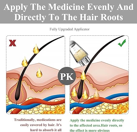 Hair Oil Applicator - SHOPIZEM