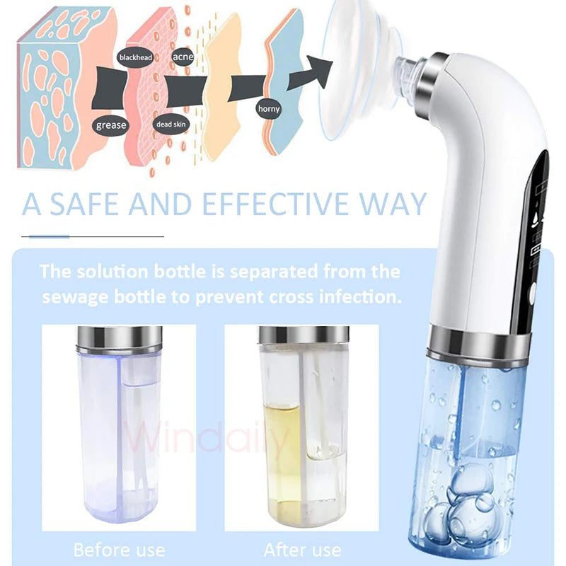 HydraFacial Bubble Blackhead Remover - SHOPIZEM