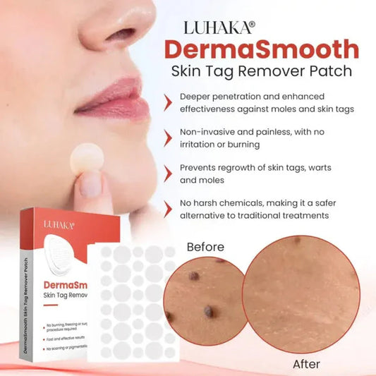 Skin Tag Remover Patch - SHOPIZEM
