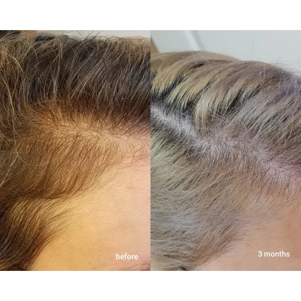 Hair Density Multi-Peptide Serum by The Ordinary - SHOPIZEM