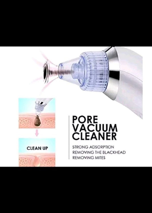 Derma Suction Vacuum Blackhead Remover - SHOPIZEM