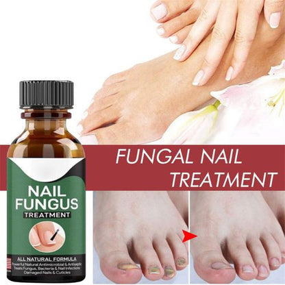 Fast Nail Fungal Treatment: Nail Repair Essences Serum - SHOPIZEM