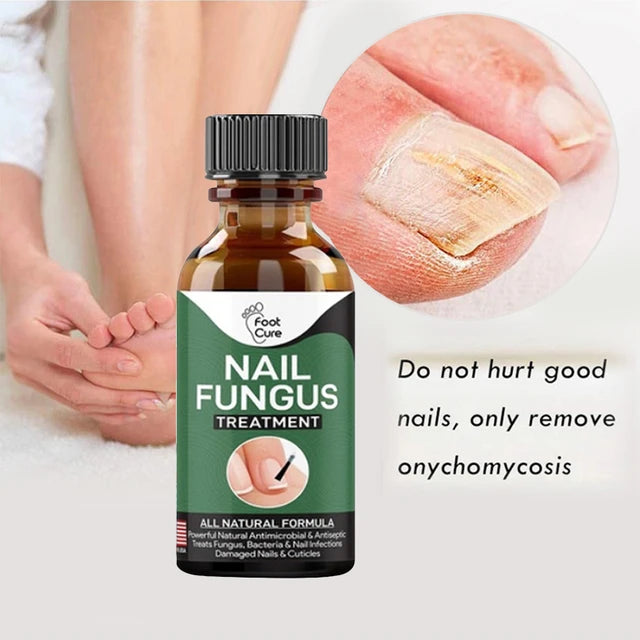 Fast Nail Fungal Treatment: Nail Repair Essences Serum