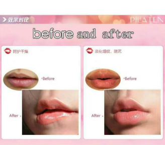 Lip Mask - SHOPIZEM