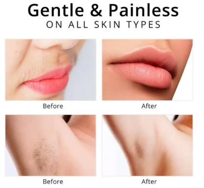 Facial Hair Removal - SHOPIZEM