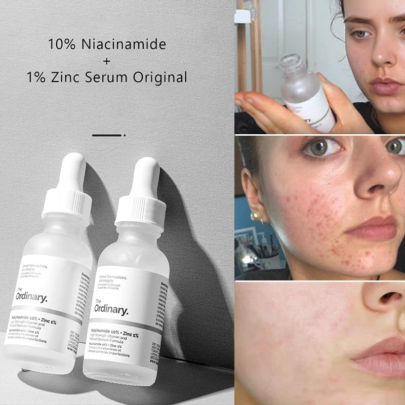 Niacinamide 10 Percent Serum UAE