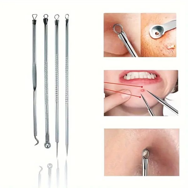 Blackhead Remover 4-in-1 Stainless Steel Beauty Tool Set - SHOPIZEM