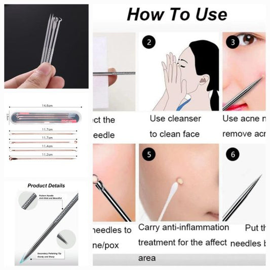 Blackhead Remover 4-in-1 Stainless Steel Beauty Tool Set - SHOPIZEM