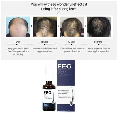 FEG PLUS Hair Growth Spray - SHOPIZEM 