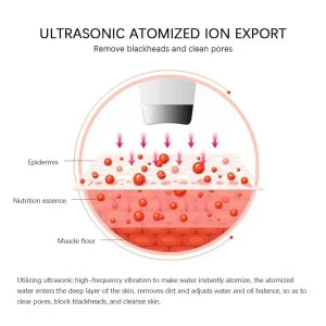 Ultrasonic Skin Scraper Blackhead Remover - SHOPIZEM