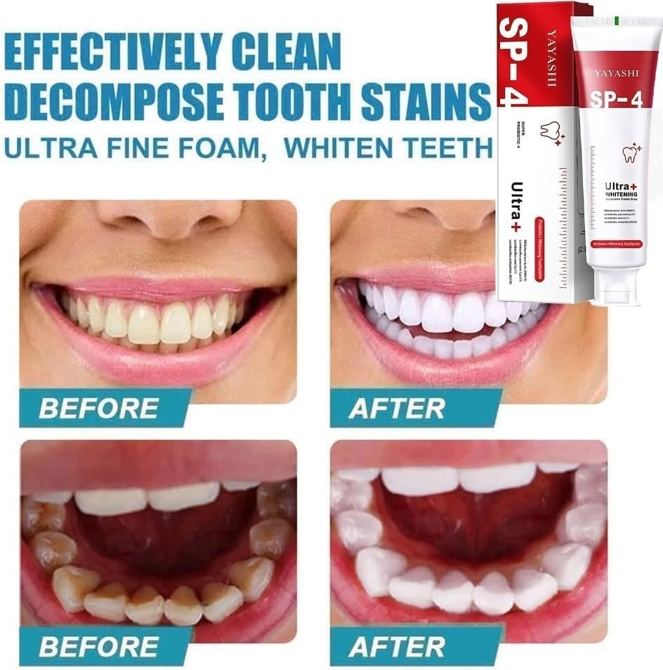 SP 4 Ultra Toothpaste