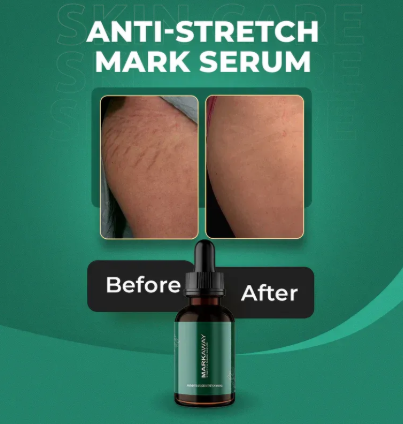 Stretch Marks Serum - SHOPIZEM 