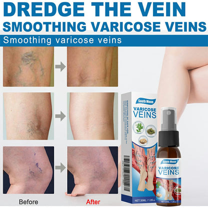 Varicose Veins Spray - SHOPIZEM 