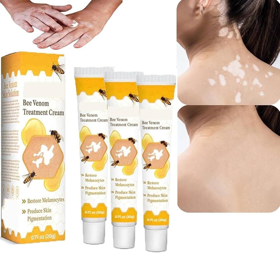 VitiGO Bee Venom Correcting Cream - SHOPIZEM 