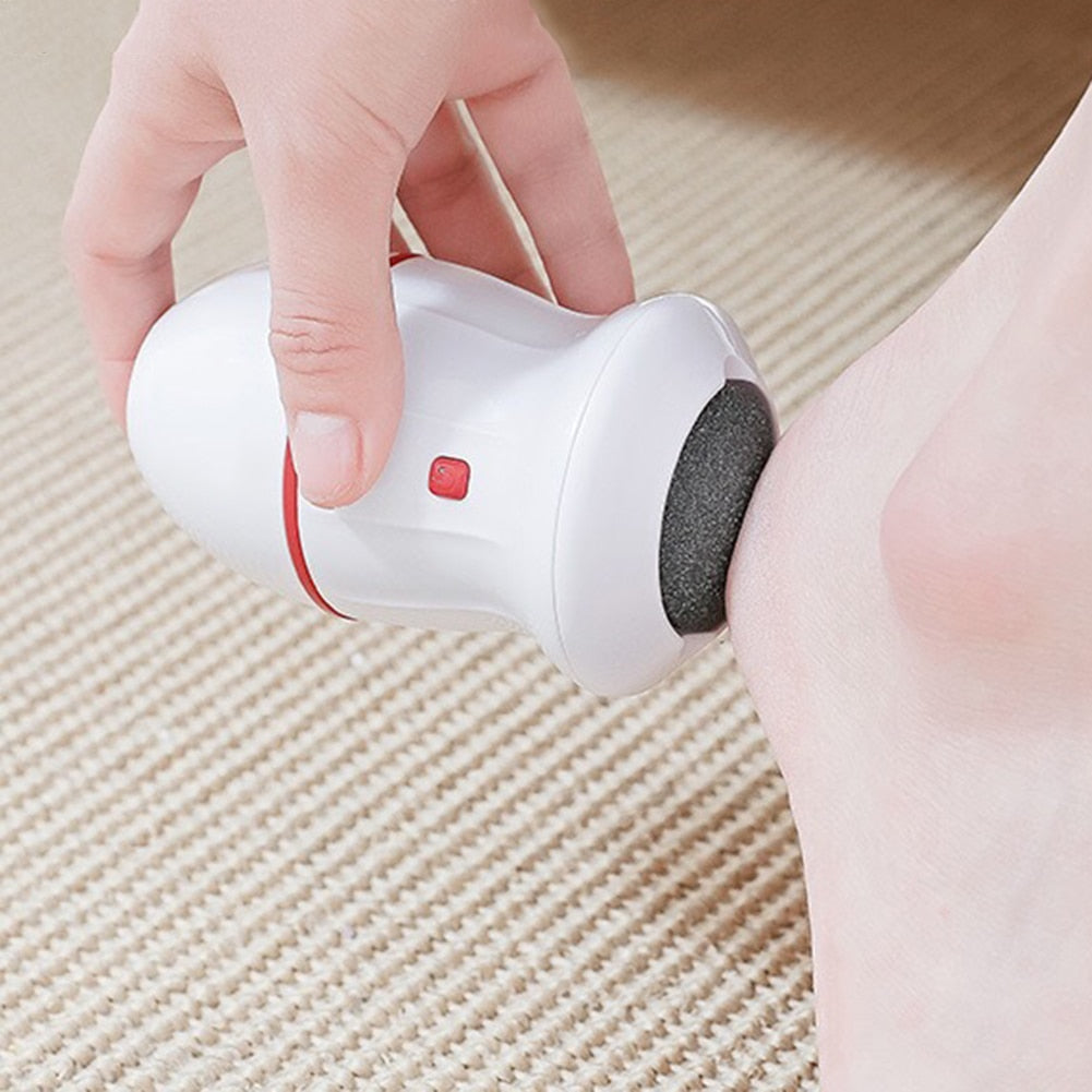 Electric Foot Callus Remover with Vacuum Absorption - SHOPIZEM